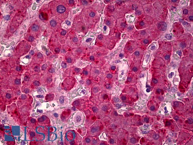 Alpha-Fetoprotein Antibody - Anti-Alpha-Fetoprotein antibody IHC of human liver. Immunohistochemistry of formalin-fixed, paraffin-embedded tissue after heat-induced antigen retrieval. Antibody concentration 20 ug/ml.