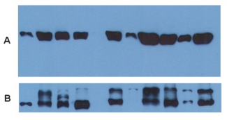 Alpha Tubulin Antibody - Use of anti-alpha-tubulin antibody TU-01 as a loading control (A) in an Western blotting experiment revealing the staining pattern of various cell lysates by a newly developed monoclonal antibody (B).