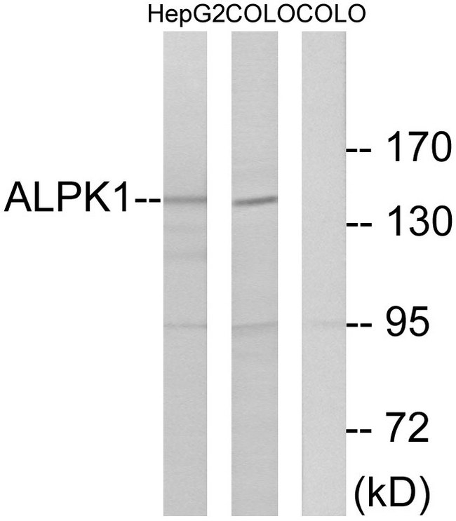 ALPK1 Antibody - Western blot analysis of lysates from COLO and HepG2 cells, using ALPK1 Antibody. The lane on the right is blocked with the synthesized peptide.