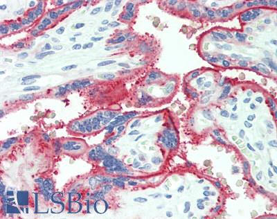 ALPPL2 Antibody - Human Placenta: Formalin-Fixed, Paraffin-Embedded (FFPE)
