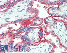 ALPPL2 Antibody - Human Placenta: Formalin-Fixed, Paraffin-Embedded (FFPE)