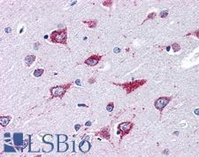 ALS2 / Alsin Antibody - Anti-ALS2 antibody IHC of human brain, cortex. Immunohistochemistry of formalin-fixed, paraffin-embedded tissue after heat-induced antigen retrieval. Antibody concentration 75 ug/ml.