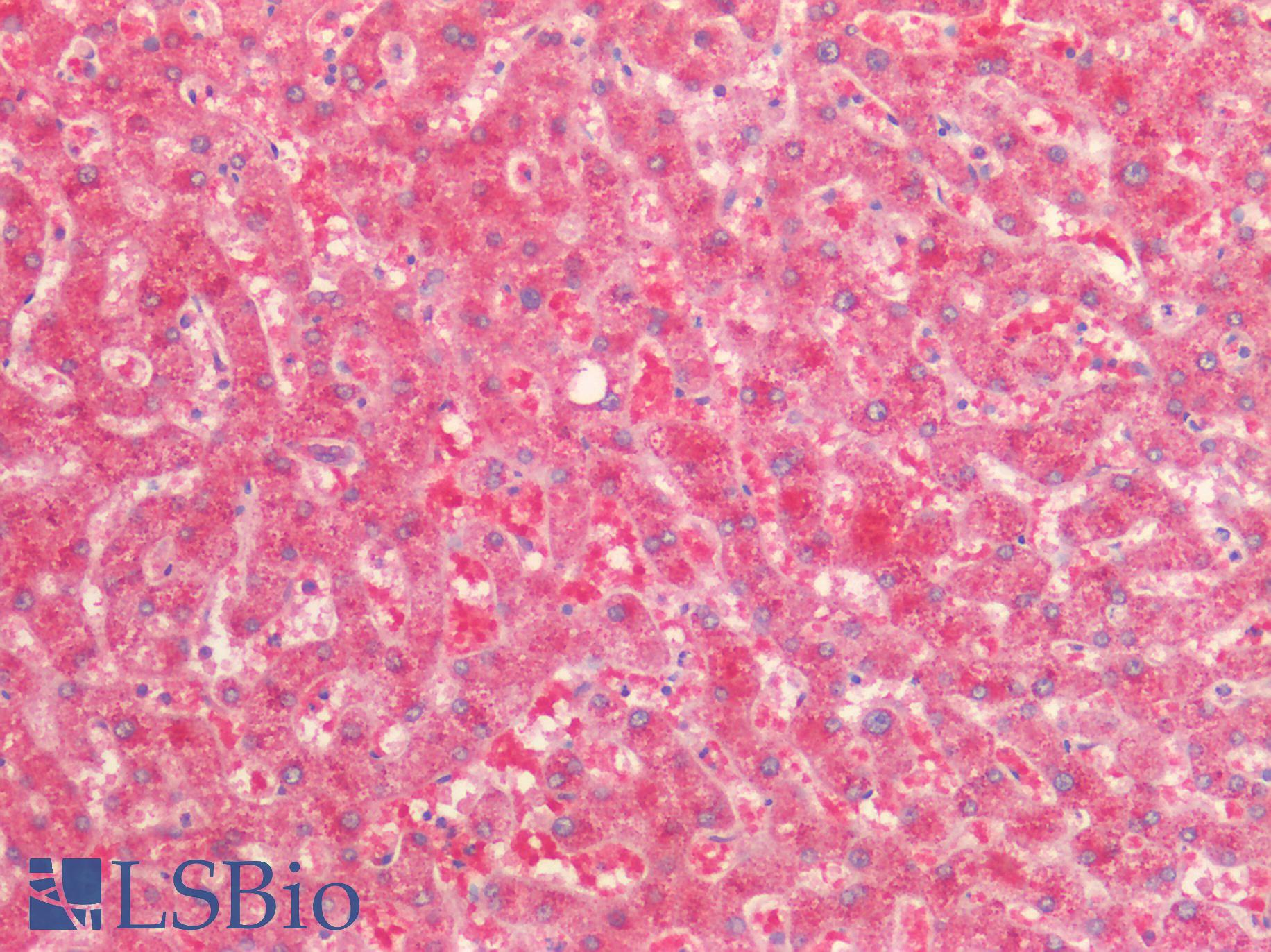 AMACR / P504S Antibody - Human Liver: Formalin-Fixed, Paraffin-Embedded (FFPE)