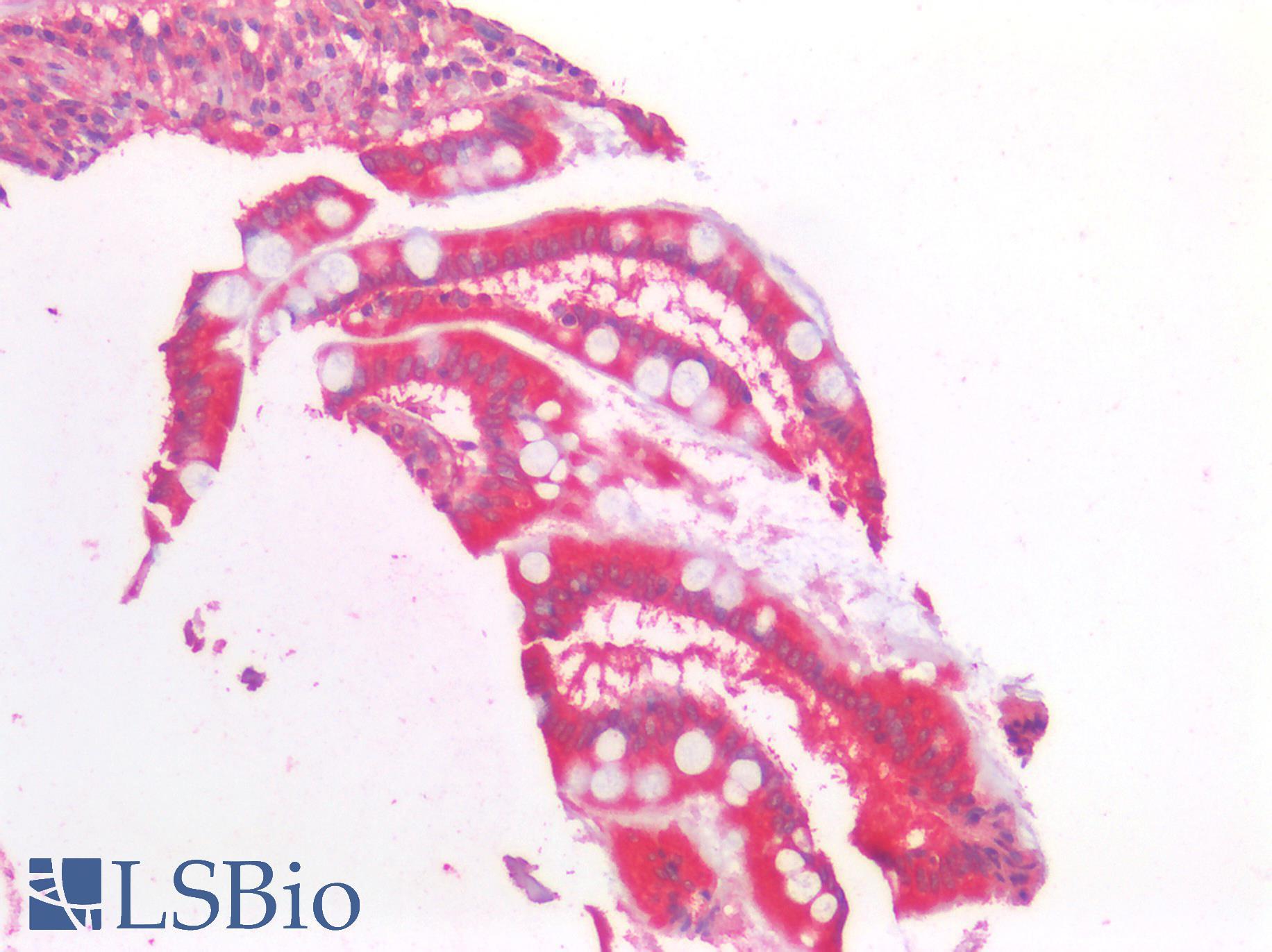 AMACR / P504S Antibody - Human Small Intestine: Formalin-Fixed, Paraffin-Embedded (FFPE)