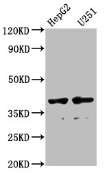 AMBP  Antibody - Western Blot Positive WB detected in: HepG2 whole cell lysate, U251 whole cell lysate All lanes: AMBP antibody at 1:1000 Secondary Goat polyclonal to rabbit IgG at 1/50000 dilution Predicted band size: 39 kDa Observed band size: 39 kDa