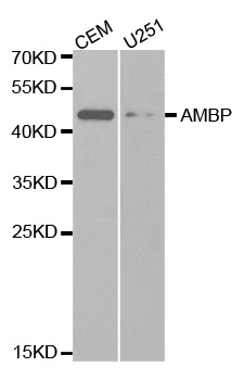 AMBP  Antibody - Western blot analysis of extracts of various cell lines, using AMBP antibody.