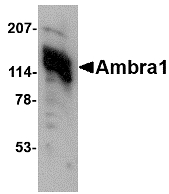 AMBRA1 Antibody - Western blot of Unc93b in human heart tissue lysate with Unc93b antibody at (A) 0.5 and (B) 1 ug/ml.