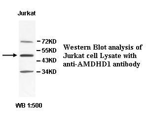AMDHD1 Antibody
