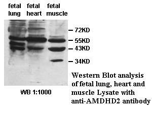 AMDHD2 Antibody