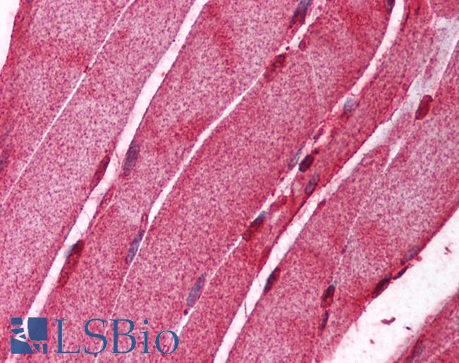 AMID / AIFM2 Antibody - Anti-AIFM2 / AMID antibody IHC of human skeletal muscle. Immunohistochemistry of formalin-fixed, paraffin-embedded tissue after heat-induced antigen retrieval. Antibody concentration 5 ug/ml.