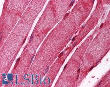 AMID / AIFM2 Antibody - Anti-AIFM2 / AMID antibody IHC of human skeletal muscle. Immunohistochemistry of formalin-fixed, paraffin-embedded tissue after heat-induced antigen retrieval. Antibody concentration 5 ug/ml.