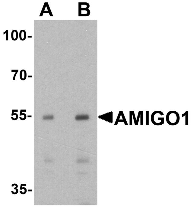 AMIGO Antibody - Western blot analysis of AMIGO1 in HeLa cell lysate with AMIGO1 antibody at (A) 1 and (B) 2 ug/ml.