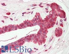 AMIGO2 Antibody - Human Breast: Formalin-Fixed, Paraffin-Embedded (FFPE)