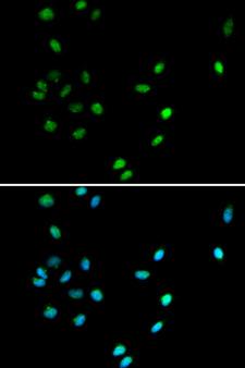AML1 / RUNX1 Antibody - Immunofluorescence analysis of A549 cell using RUNX1 antibody. Blue: DAPI for nuclear staining.
