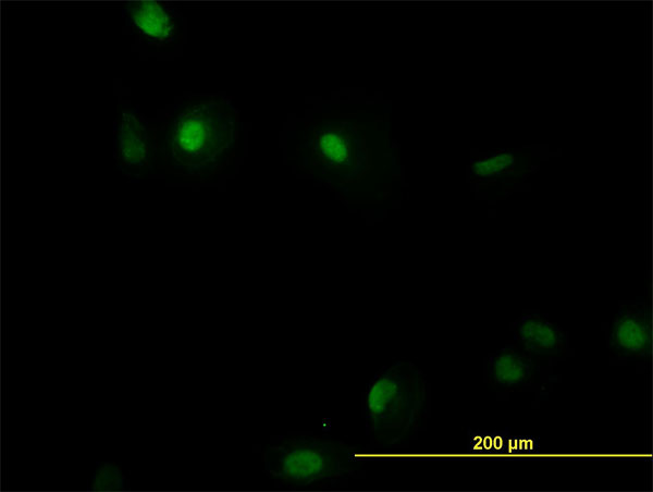 AML1 / RUNX1 Antibody - Immunofluorescence of monoclonal antibody to RUNX1 on HeLa cell. [antibody concentration 40 ug/ml]
