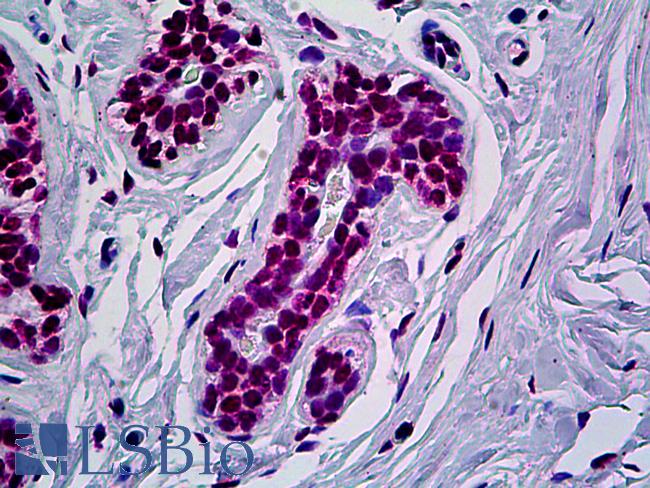 AML1 / RUNX1 Antibody - Anti-RUNX1 antibody IHC of human breast. Immunohistochemistry of formalin-fixed, paraffin-embedded tissue after heat-induced antigen retrieval. Antibody concentration 5 ug/ml.