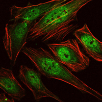 AML1 / RUNX1 Antibody - Immunofluorescence of HeLa cells using RUNX1 mouse monoclonal antibody (green). Red: Actin filaments have been labeled with Alexa Fluor-555 phalloidin.