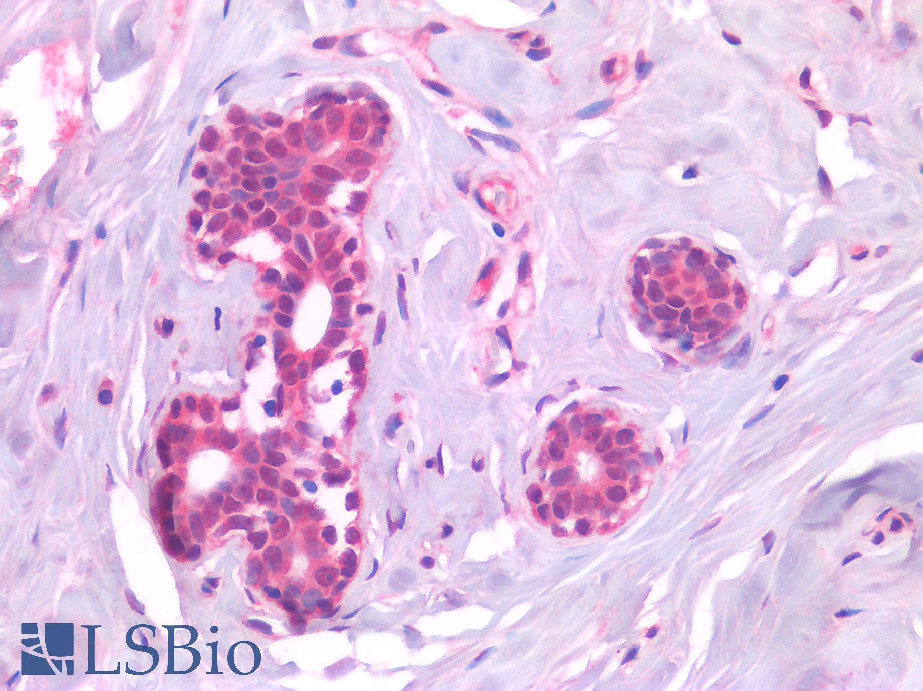 AML1 / RUNX1 Antibody - Human Breast: Formalin-Fixed, Paraffin-Embedded (FFPE)