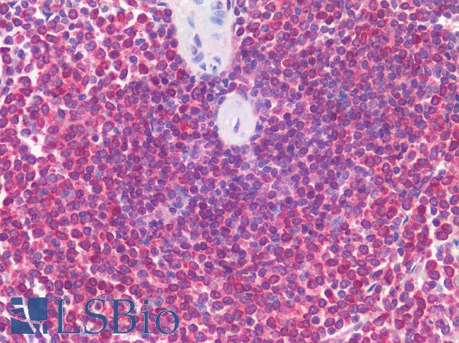 AML1 / RUNX1 Antibody - Human Spleen: Formalin-Fixed, Paraffin-Embedded (FFPE)