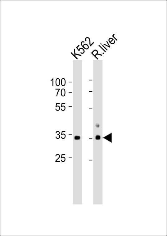 AMOG / ATP1B2 Antibody - Western blot of lysates from K562 cell line and rat liver tissue lysate(from left to right), using ATP1B2 Antibody. Antibody was diluted at 1:1000 at each lane. A goat anti-rabbit IgG H&L (HRP) at 1:10000 dilution was used as the secondary antibody. Lysates at 35ug per lane.