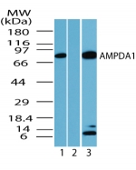 AMPD1 Antibody - Western blot of human AMPDA1 inumouse skeletal muscle lysate in the 1) absence, 2) presence of immunizing peptide and 3)?rat skeletal muscle using antibody at 1 ug/ml.