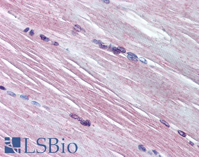AMPD1 Antibody - Anti-AMPD1 antibody IHC of human skeletal muscle. Immunohistochemistry of formalin-fixed, paraffin-embedded tissue after heat-induced antigen retrieval. Antibody concentration 10 ug/ml.