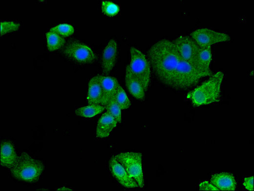 AMPD2 Antibody - Immunofluorescent analysis of HepG2 cells using AMPD2 Antibody at a dilution of 1:100 and Alexa Fluor 488-congugated AffiniPure Goat Anti-Rabbit IgG(H+L)