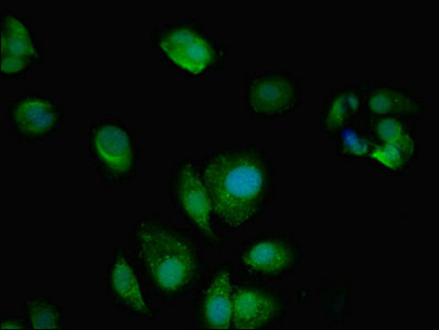 AMPD2 Antibody - Immunofluorescent analysis of MCF-7 cells using AMPD2 Antibody at dilution of 1:100 and Alexa Fluor 488-congugated AffiniPure Goat Anti-Rabbit IgG(H+L)