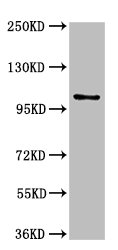 AMPD2 Antibody - Western Blot Positive WB detected in: U87 whole cell lysate All lanes: AMPD2 antibody at 3µg/ml Secondary Goat polyclonal to rabbit IgG at 1/50000 dilution Predicted band size: 101, 93, 89 kDa Observed band size: 101 kDa