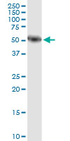 AMY1A / Salivary Amylase Antibody - AMY1A monoclonal antibody, clone 2D4. Western blot of AMY1A expression in human pancreas.