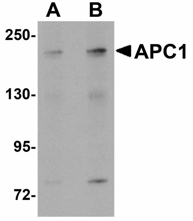 ANAPC1 / APC1 Antibody - Western blot of APC1 in SK-N-SH cell lysate with APC1 antibody at (A) 1 and (B) 2 ug/ml.