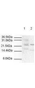 ANAPC10 / APC10 Antibody - Anti-APC10 Antibody - Western Blot. Affinity Purified Rabbit anti-APC10 was used at a 1:500 dilution to detect human APC10 by western blot. Both HeLa whole cell lysate (lane 1) and nuclear lysate (lane 2) were probed using this antibody. Approximately 20 ug of each lysate was loaded onto a 10% SDS-PAGE gel. Primary antibody was reacted with the membrane at room temperature for 1 h. After subsequent washing, a 1:2000 dilution of HRP conjugated Gt-a-Rabbit IgG was used for visualization. Exposure time was 5 min. The expected molecular weight of human APC10 is 21 kD.