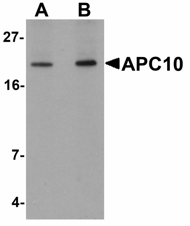 ANAPC10 / APC10 Antibody - Western blot of APC10 in mouse heart tissue lysate with APC10 antibody at (A) 1 and (B) 2 ug/ml.