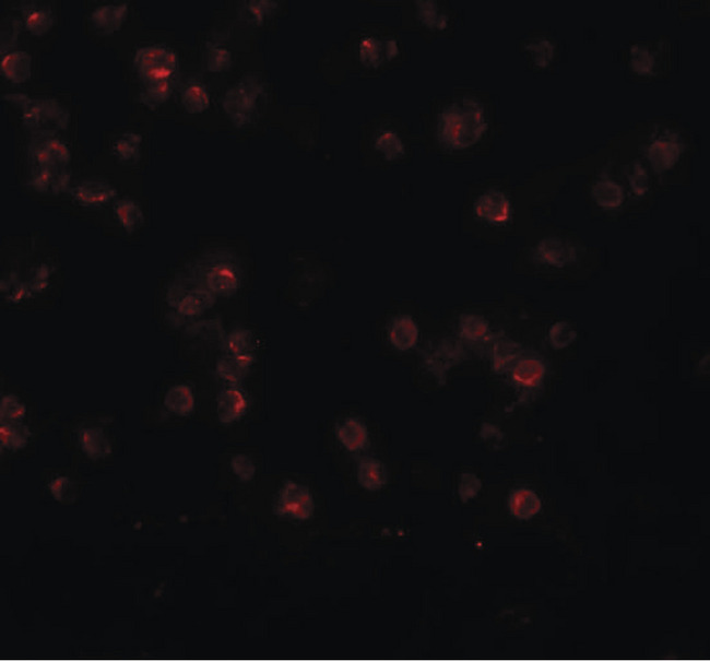ANAPC13 Antibody - Immunofluorescence of APC13 in Jurkat cells with APC13 antibody at 20 ug/ml.