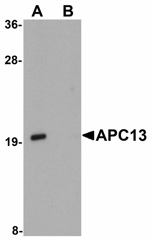 ANAPC13 Antibody - Western blot of APC13 in Jurkat cell tissue lysate with APC13 antibody at 1 ug/ml in (A) the absence and (B) the presence of blocking peptide.