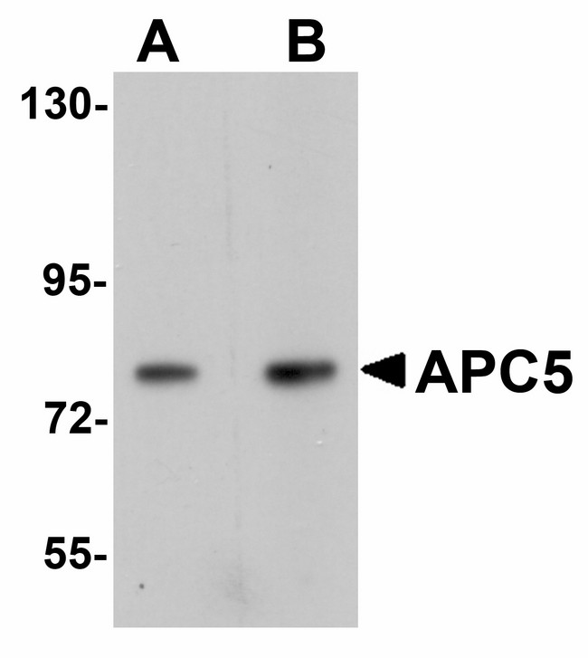 ANAPC5 / APC5 Antibody - Western blot of APC5 in human kidney tissue lysate with APC5 antibody at (A) 1 and (B) 2 ug/ml.