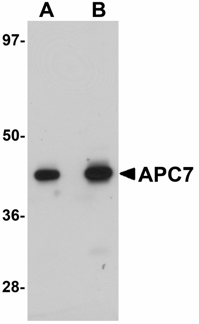 ANAPC7 / APC7 Antibody - Western blot of APC7 in rat kidney tissue lysate with APC7 antibody at (A) 1 and (B) 2 ug/ml.