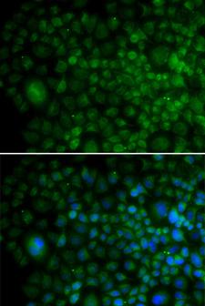 Angiogenin / ANG Antibody - Immunofluorescence analysis of U2OS cells using ANG antibody and counter-stained with DAPI for nuclear staining.