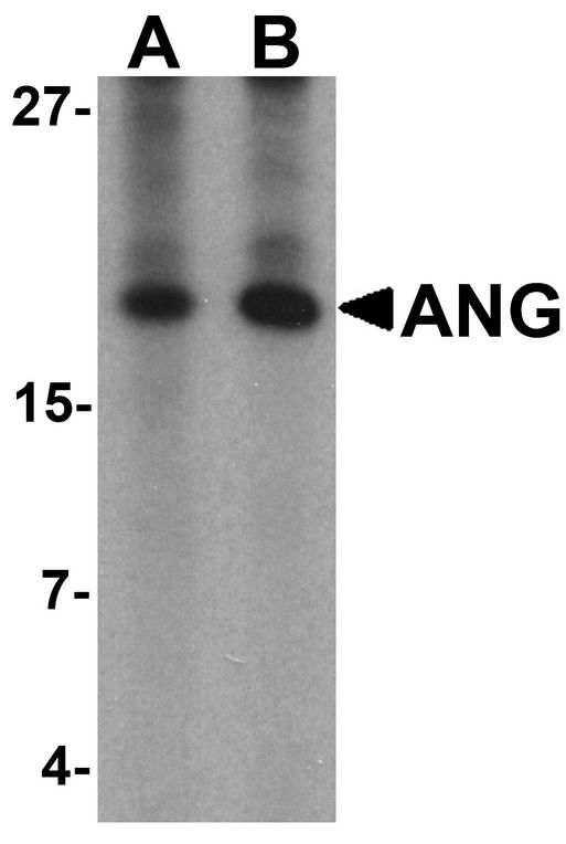 Angiogenin / ANG Antibody - Western blot analysis of ANG in rat liver tissue lysate with Ang antibody at (A) 1 and (B) 2 ug/ml.