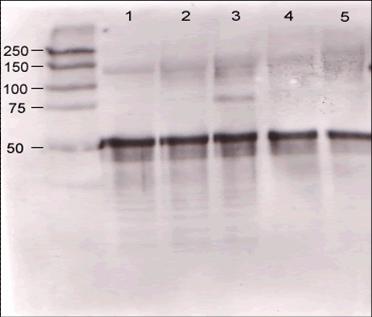 ANGPT1 / Angiopoietin-1 Antibody - Rabbit anti-Ang-1 was used at a 1:500 dilution to detect mouse Ang-1 by western blot against supernatants of mouse angiopoietin-expressing endothelial cells.   Lane 1 - wt endothelial cells.  Lane 2 - mouse Ang-1 (clone 1-8) expressing cells.  Lane 3 - mouse Ang-1 (clone 1-15) expressing cells.  Lane 4 - mouse Ang-2 (clone 2-9) expressing cells.