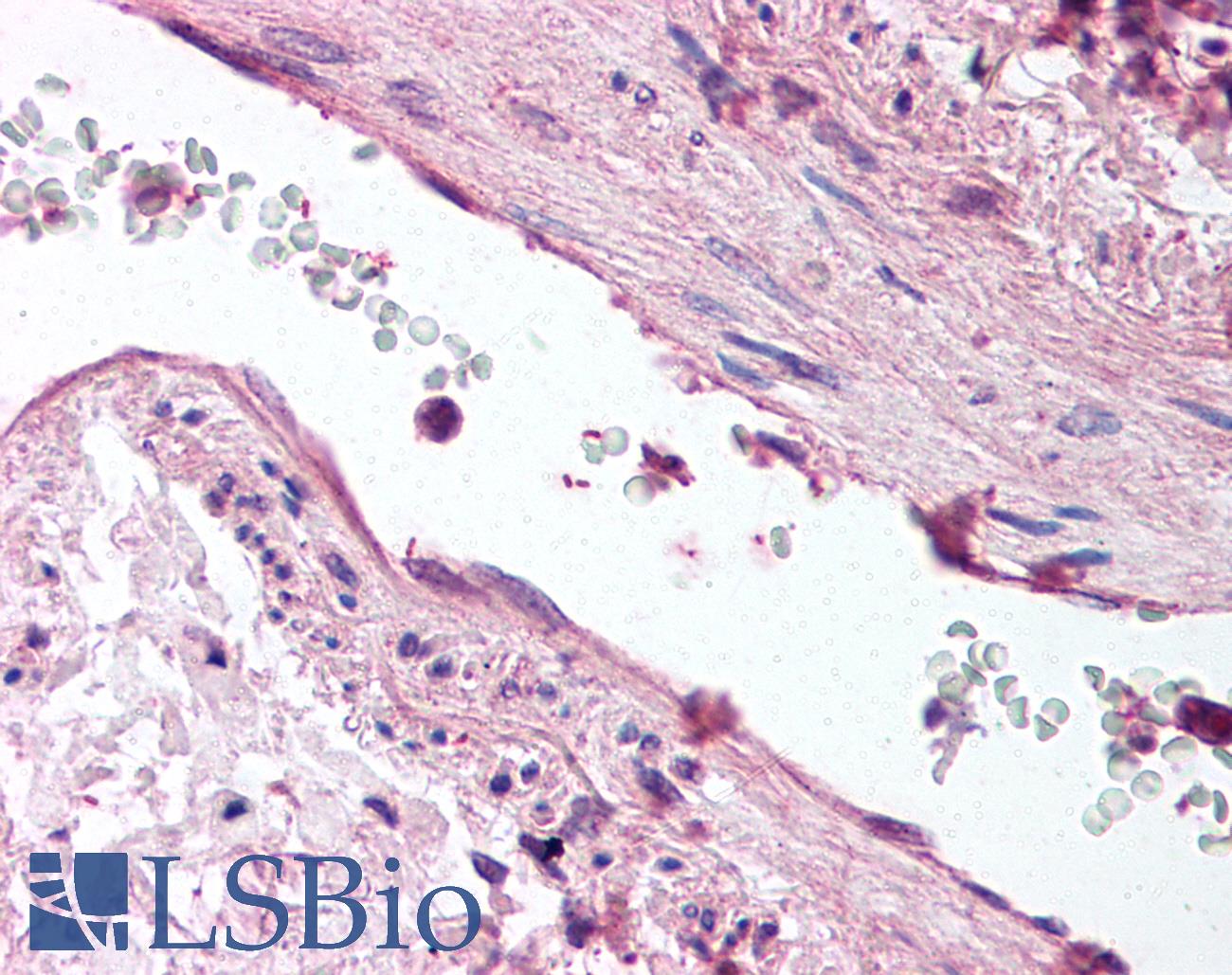 ANGPT1 / Angiopoietin-1 Antibody - Anti-ANGPT1 / Angiopoietin-1 antibody IHC staining of human lung, vessel. Immunohistochemistry of formalin-fixed, paraffin-embedded tissue after heat-induced antigen retrieval. Antibody dilution 1:200.