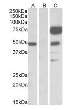 ANGPT1 / Angiopoietin-1 Antibody - HEK293 lysate (10 ug protein in RIPA buffer) overexpressing Human ANGPT1 with DYKDDDDK tag probed with ANGPT1 antibody (1 ug/ml) in Lane A and probed with anti-DYKDDDDK Tag (1/1000) in lane C. Mock-transfected HEK293 probed with ANGPT1 antibody (1 mg/ml) in Lane B. Primary incubations were for 1 hour. Detected by chemiluminescence.