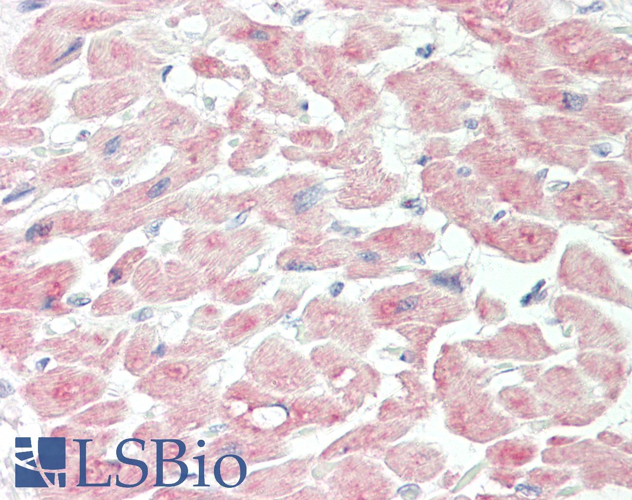 ANGPTL3 Antibody - Human Heart: Formalin-Fixed, Paraffin-Embedded (FFPE).  This image was taken for the unconjugated form of this product. Other forms have not been tested.