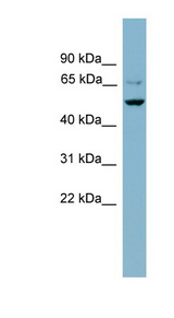 ANGPTL3 Antibody - ANGPTL3 antibody Western blot of NCI-H226 cell lysate. This image was taken for the unconjugated form of this product. Other forms have not been tested.