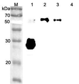 ANGPTL3 Antibody - Western blot analysis using anti-ANGPTL3 (CCD) (human), pAb at 1:2000 dilution. 1: Human ANGPTL3 (CCD) (FLAG-tagged). 2: Human ANGPTL3 (FLAG-tagged). 4: Mouse RBP4 (FLAG-tagged) (negative control).
