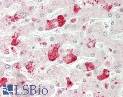 ANGPTL3 Antibody - Human Liver: Formalin-Fixed, Paraffin-Embedded (FFPE)