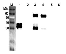 ANGPTL3 Antibody - Western blot analysis using anti-ANGPTL3 (FLD) (human), pAb at 1:2000 dilution. 1: Human ANGPTL3 (FLD) (FLAG-tagged). 2: Human ANGPTL3 (CCD) (FLAG-tagged). 4: Human ANGPTL3 (FLAG-tagged). 5: Human ANGPTL6 (FLAG-tagged). 6: Human ANGPTL7 (FLAG-tagged).