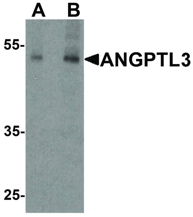 ANGPTL3 Antibody - Western blot analysis of ANGPTL3 in human heart tissue lysate with ANGPTL3 antibody at (A) 1 and (B) 2 ug/ml.
