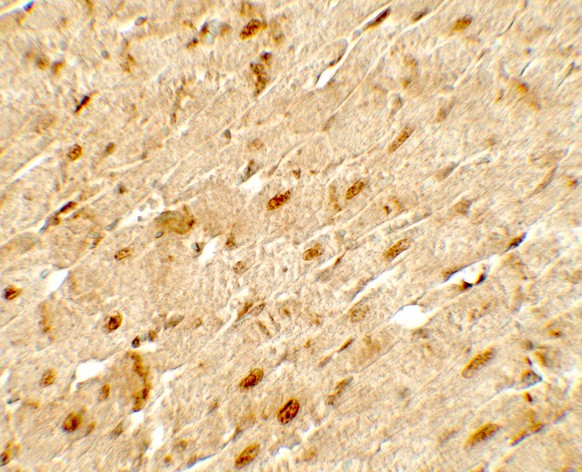 ANGPTL3 Antibody - Immunohistochemistry of ANGPTL3 in rat heart tissue with ANGPTL3 antibody at 5 ug/mL.