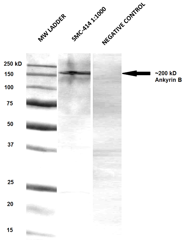 ANK2 / Ankyrin B Antibody - Western blot of rat brain membrane lysates showing the detection of ~200kDa Ankyrin B protein using Anti-Ankyrin B antibody [S105-17] (ANK2 / Ankyrin B antibody). Lane 1: MW ladder. Lane 2: Anti-Ankyrin B (1:1000). Lane 3: Negative control (no primary Ab). Load: 33 ug per lane. Block: 5% milk + TBST overnight at 4°C. Primary antibody: Mouse Anti-Ankyrin B antibody [S105-17] (ANK2 / Ankyrin B antibody) at 1:1000 dilution in TBS for 60 min at RT.  This image was taken for the unconjugated form of this product. Other forms have not been tested.